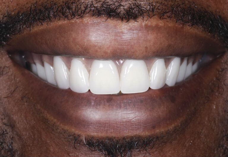 Closeup of a man smiling
